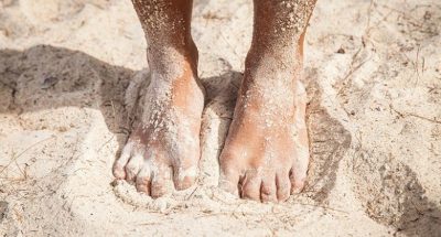 Prevent Sand Fleas in CUba